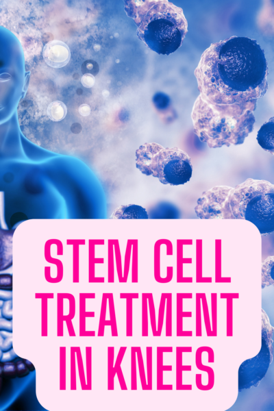 stem cell treatment in knees